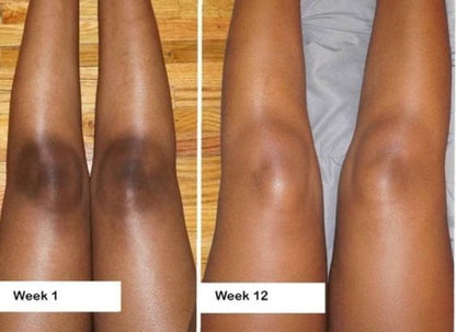 Black Friday : SOLIQ ™ Tumeric Kojic&  Acid Soap